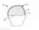Fig. 01 - Method for fabricating a medical implant component and such component