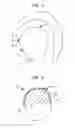 Fig. 02 - Method for fabricating a medical implant component and such component