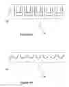 Fig. 06 - Switching micro-resonant structures using at least one director