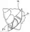Fig. 01 - Dental matrix