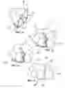 Fig. 03 - Dental matrix