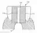 Fig. 01 - Assistant for implant stent