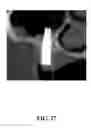 Fig. 28 - System and method for the design, creation and installation of implant-supported dental prostheses