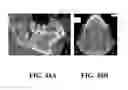 Fig. 49 - System and method for the design, creation and installation of implant-supported dental prostheses