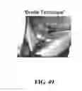 Fig. 50 - System and method for the design, creation and installation of implant-supported dental prostheses