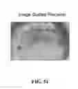 Fig. 52 - System and method for the design, creation and installation of implant-supported dental prostheses
