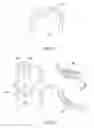 Fig. 05 - Method of making dental implant plate