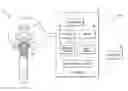 Fig. 01 - Method and apparatus for predicting the operating points of bone cement