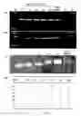 Fig. 02 - Differential amplification of mutant nucleic acids by PCR in a mixure of nucleic acids