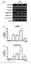 Fig. 01 - Biomarkers for kidney diseases and method for using same