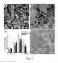 Fig. 06 - Biomarkers for kidney diseases and method for using same