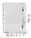 Fig. 02 - Nucleic acid molecules encoding a novel ectoparasite saliva protein