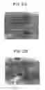 Fig. 03 - Assays employing randomly distributed microbeads with attached biomolecules