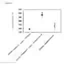Fig. 04 - Method of quickly detecting and/or assaying antigen by fluorescence correlation spectrometry