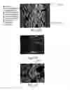 Fig. 11 - Multiplex in situ immunohistochemical analysis