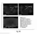 Fig. 19 - Multiplex in situ immunohistochemical analysis