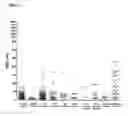 Fig. 03 - Method for assessing disease states by profile analysis of isolated circulating endothelial cells