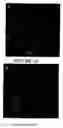 Fig. 10 - Chlorotoxin-labeled nanoparticle compositions and methods for targeting primary brain tumors
