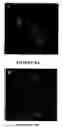 Fig. 12 - Chlorotoxin-labeled nanoparticle compositions and methods for targeting primary brain tumors
