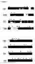 Fig. 02 - Method of diagnosing myasthenia gravis and kits therefor