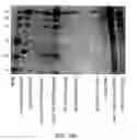 Fig. 33 - Method for the production and purification of adenoviral vectors
