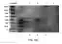 Fig. 35 - Method for the production and purification of adenoviral vectors