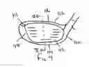 Fig. 04 - Golf club head