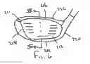 Fig. 06 - Golf club head