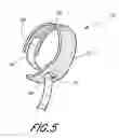 Fig. 06 - Throw toy