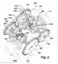Fig. 04 - Differential transmission system