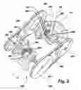 Fig. 05 - Differential transmission system