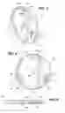 Fig. 03 - Weight plate for interlocking and weight adjustment