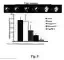 Fig. 04 - Methods of use of fibroblast growth factor, vascular endothelial growth factor and related proteins in the treatment of acute and chronic heart disease