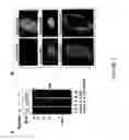 Fig. 03 - Trisubstituted aryl and heteroaryl derivatives as modulators of metabolism and the prophylaxis and treatment of disorders related thereto