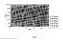 Fig. 02 - Pharmaceutical composition of vinflunine which is intended for parenteral administration preparation method thereof and use of same