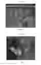 Fig. 19 - Poly(ureaurethane)s, articles and coatings prepared therefrom and methods of making the same