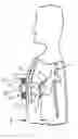Fig. 01 - Stabilization for electromagnetic biventricular assist device