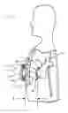 Fig. 02 - Stabilization for electromagnetic biventricular assist device
