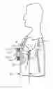 Fig. 01 - Cardiac diastolic augmentation improving cardiac output in electromagnetic biventricular assist device