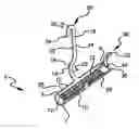 Fig. 01 - Stress urinary incontinence implant and device for deploying same