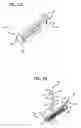 Fig. 03 - Stress urinary incontinence implant and device for deploying same