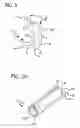 Fig. 04 - Stress urinary incontinence implant and device for deploying same