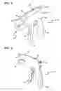 Fig. 05 - Stress urinary incontinence implant and device for deploying same