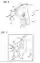 Fig. 06 - Stress urinary incontinence implant and device for deploying same