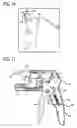 Fig. 08 - Stress urinary incontinence implant and device for deploying same