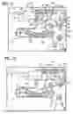 Fig. 09 - Stress urinary incontinence implant and device for deploying same
