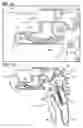 Fig. 10 - Stress urinary incontinence implant and device for deploying same