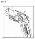 Fig. 14 - Stress urinary incontinence implant and device for deploying same