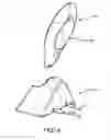 Fig. 14 - Self-regulating gastric band with pressure data processing