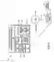Fig. 17 - Self-regulating gastric band with pressure data processing